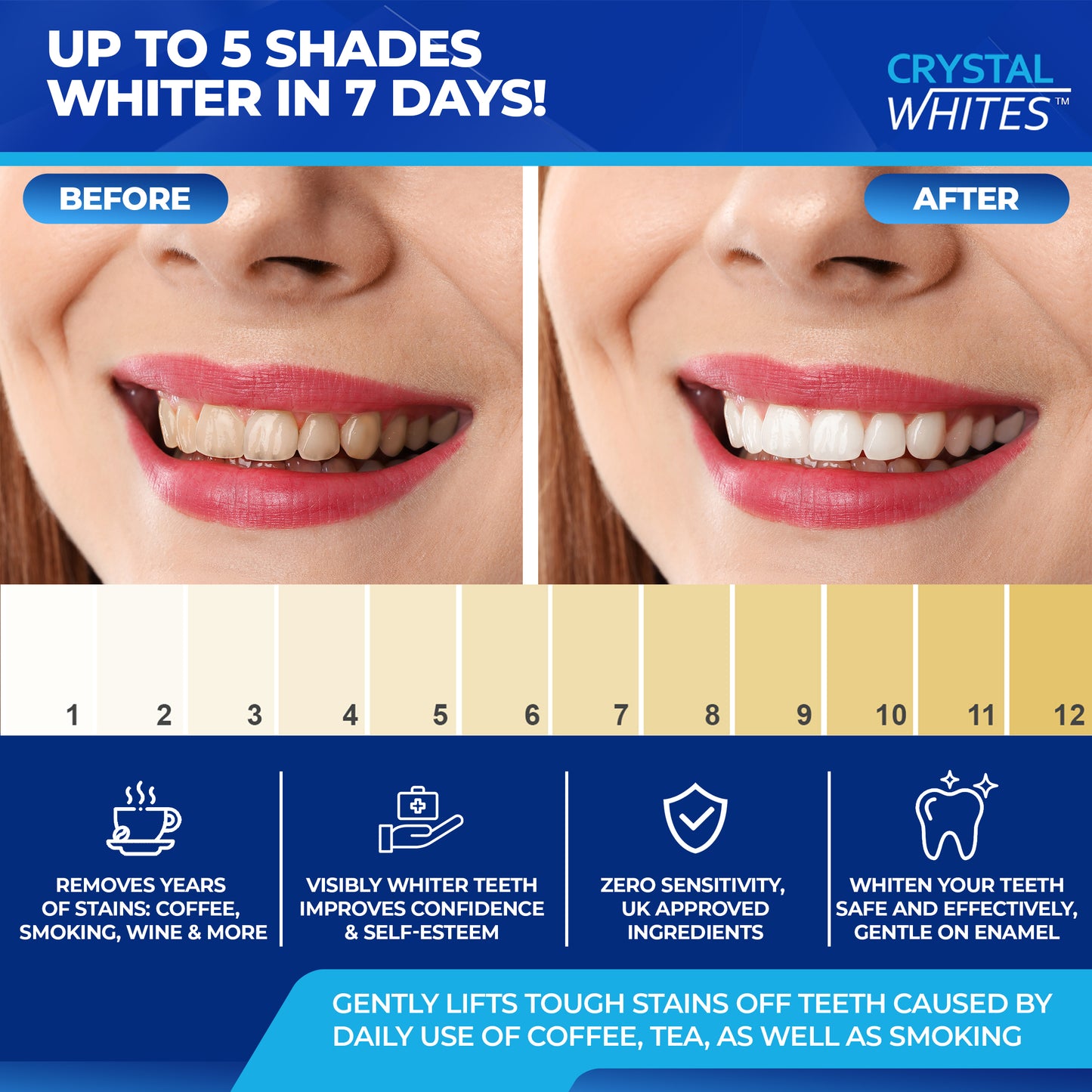 8 Gel Teeth Whitening Kit & 7 Deluxe Strips - Ultimate Kit - Crystal Whites