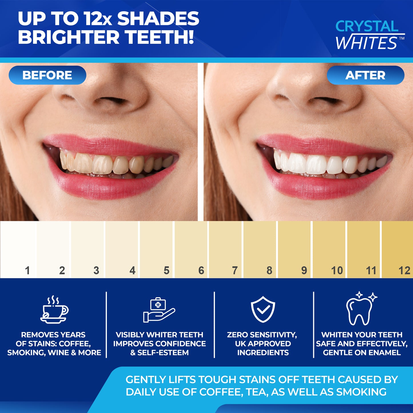 Deluxe Teeth Whitening Strips & LED Laser Light - 50 Pack - Crystal Whites